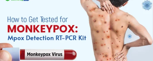 Mpox Detection RT-PCR Kit