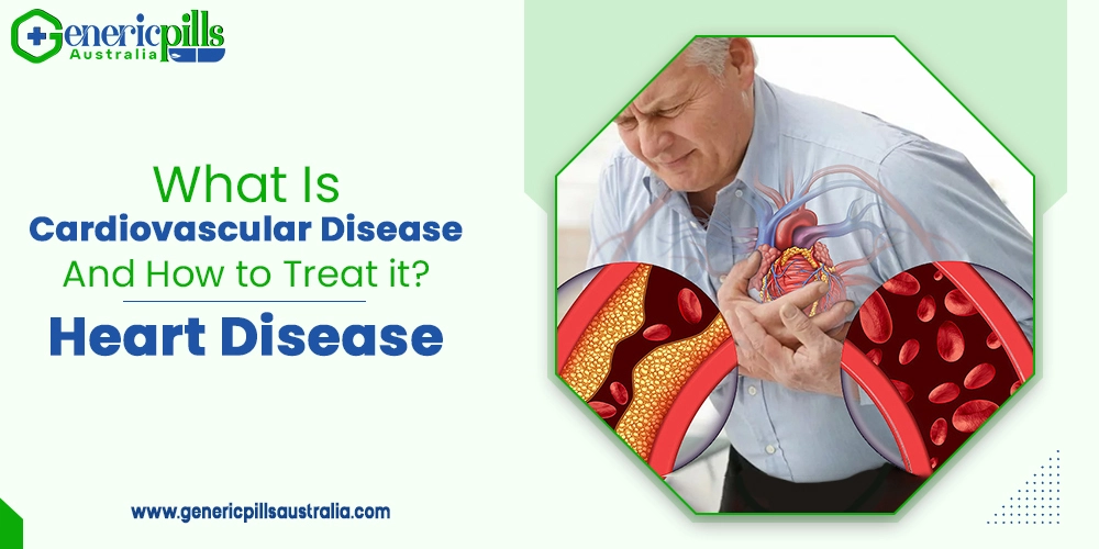 What Is Cardiovascular Disease and How to Treat it? | Heart Disease | 